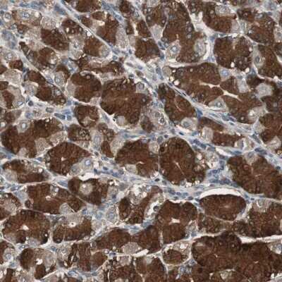 Immunohistochemistry-Paraffin: Calpain S1 Antibody [NBP1-90329]