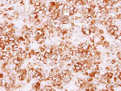 Immunohistochemistry-Paraffin: Calpain S1 Antibody [NBP2-15677]