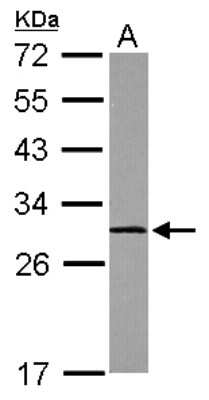 Western Blot: Calpain S1 Antibody [NBP2-15677]