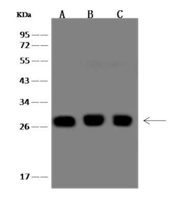 Western Blot: Calpain S1 Antibody [NBP3-06243]