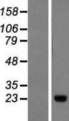 Western Blot: Calpain S1 Overexpression Lysate [NBP2-10772]