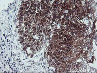 Immunohistochemistry-Paraffin: Calpastatin Antibody (OTI1E7) [NBP2-01819]
