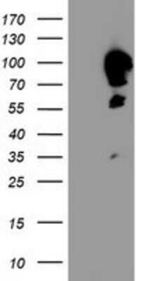 Western Blot: Calpastatin Antibody (OTI1E7) [NBP2-01819]