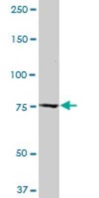 Western Blot: Calpastatin Antibody (2C5) [H00000831-M03]