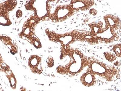 Immunohistochemistry-Paraffin: Calpastatin Antibody (CAST/1550) - Azide and BSA Free [NBP3-08510]