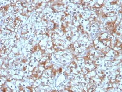 Immunohistochemistry-Paraffin: Calpastatin Antibody (CAST/1550) - Azide and BSA Free [NBP3-08510]