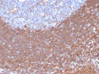 Immunohistochemistry-Paraffin: Calpastatin Antibody (CAST/1550) - Azide and BSA Free [NBP3-08510]