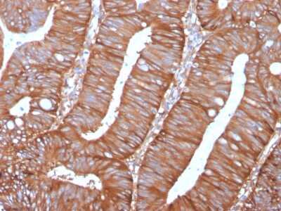 Immunohistochemistry-Paraffin: Calpastatin Antibody (CAST/1550) [NBP3-07397]