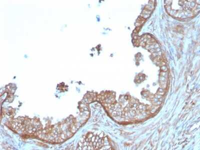 Immunohistochemistry-Paraffin: Calpastatin Antibody (CAST/1550) [NBP3-07397]