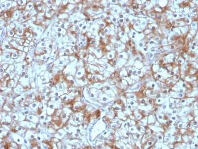 Immunohistochemistry-Paraffin: Calpastatin Antibody (CAST/1550) [NBP3-07397]