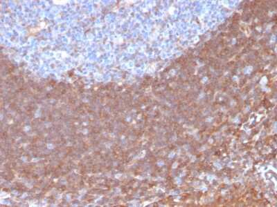 Immunohistochemistry-Paraffin: Calpastatin Antibody (CAST/1550) [NBP3-07397]