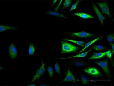 Immunocytochemistry/ Immunofluorescence: Calpastatin Antibody [H00000831-B02P]