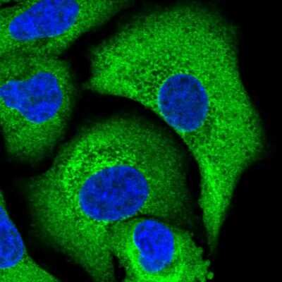 Immunocytochemistry/ Immunofluorescence: Calpastatin Antibody [NBP2-38335]