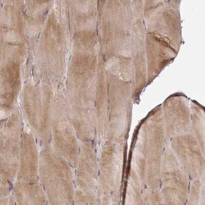 Immunohistochemistry-Paraffin: Calpastatin Antibody [NBP2-38335]