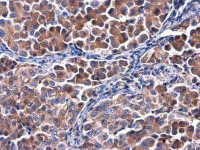 Immunohistochemistry-Paraffin: Calpastatin Antibody [NBP2-15678]