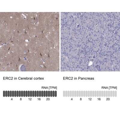 Immunohistochemistry-Paraffin: ERC2 Antibody [NBP2-62683]