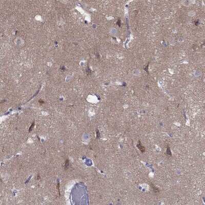 Immunohistochemistry-Paraffin: ERC2 Antibody [NBP2-62683]