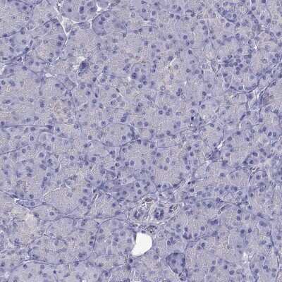 Immunohistochemistry-Paraffin: ERC2 Antibody [NBP2-62683]