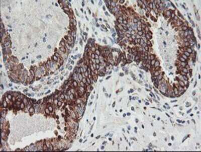 Immunohistochemistry: Calpastatin Antibody (OTI1E7) - Azide and BSA Free [NBP2-70338]