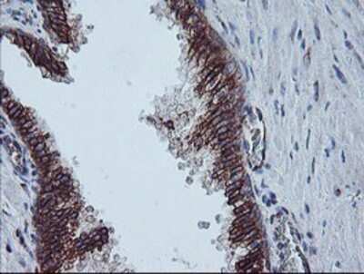 Immunohistochemistry: Calpastatin Antibody (OTI1E7) - Azide and BSA Free [NBP2-70338]