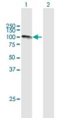 Western Blot: Calpastatin Antibody [H00000831-B02P]