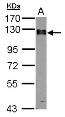 Western Blot: Calpastatin Antibody [NBP2-15678]