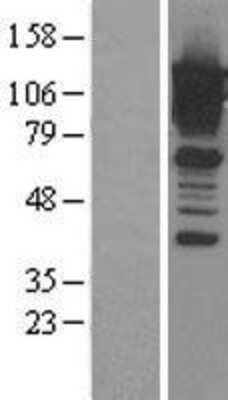 Western Blot: Calpastatin Overexpression Lysate [NBL1-08722]