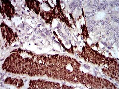 Immunohistochemistry: Calponin 1 Antibody (1H5B5) - BSA Free [NBP2-52445]