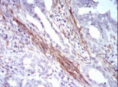 Immunohistochemistry-Paraffin: Calponin 1 Antibody (1H5B5) - BSA Free [NBP2-52445]