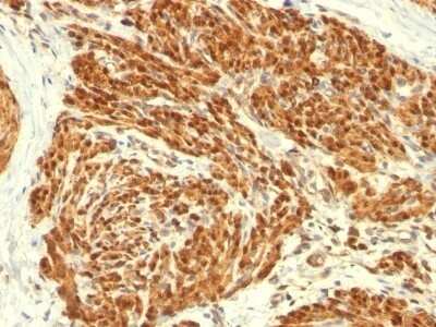 Immunohistochemistry-Paraffin: Calponin 1 Antibody (CALP) - Azide and BSA Free [NBP2-47712]