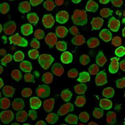 Immunocytochemistry/ Immunofluorescence: Calponin 1 Antibody (CALP) [NBP2-44479]