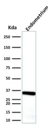 Western Blot: Calponin 1 Antibody (CALP) [NBP2-44479]