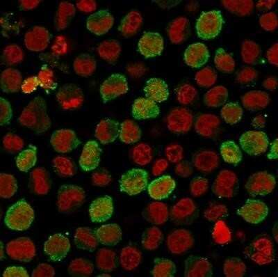 Immunocytochemistry/ Immunofluorescence: Calponin 1 Antibody (CNN1/1408R) - Azide and BSA Free [NBP2-54378]