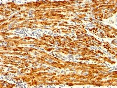 Immunohistochemistry-Paraffin: Calponin 1 Antibody (CNN1/1408R) - Azide and BSA Free [NBP2-54378]
