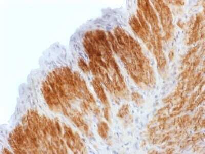 Immunohistochemistry-Paraffin: Calponin 1 Antibody (CNN1/1408R) - Azide and BSA Free [NBP2-54378]