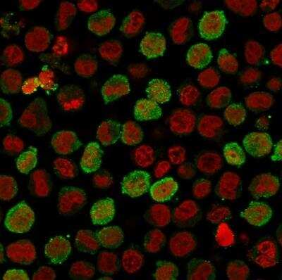 Immunocytochemistry/ Immunofluorescence: Calponin 1 Antibody (CNN1/1408R) [NBP2-53233]