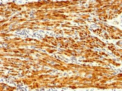 Immunohistochemistry-Paraffin: Calponin 1 Antibody (CNN1/1408R) [NBP2-53233]