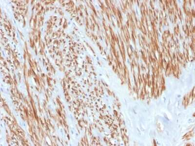 Immunohistochemistry-Paraffin: Calponin 1 Antibody (CNN1/4227R) - Azide and BSA Free [NBP3-08462]