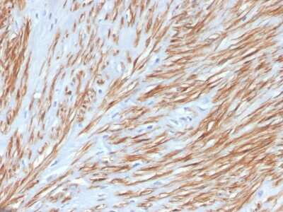 Immunohistochemistry-Paraffin: Calponin 1 Antibody (CNN1/4227R) - Azide and BSA Free [NBP3-08462]