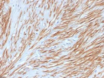 Immunohistochemistry-Paraffin: Calponin 1 Antibody (CNN1/4227R) [NBP3-07589]