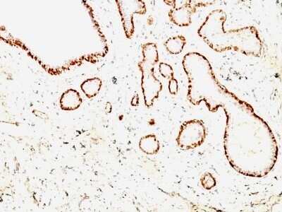 Immunohistochemistry-Paraffin: Calponin 1 Antibody (CNN1/832 + CALP) - Azide and BSA Free [NBP2-47758]