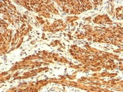Immunohistochemistry-Paraffin: Calponin 1 Antibody (CNN1/832 + CALP) - Azide and BSA Free [NBP2-47758]