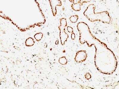 Immunohistochemistry-Paraffin: Calponin 1 Antibody (CNN1/832 + CALP) - IHC-Prediluted [NBP2-48206]