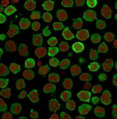 Immunocytochemistry/ Immunofluorescence: Calponin 1 Antibody (CNN1/832 + CALP) [NBP2-44482]