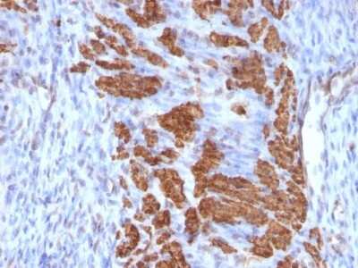 Immunohistochemistry-Paraffin: Calponin 1 Antibody (CNN1/832 + CALP) [NBP2-44482]