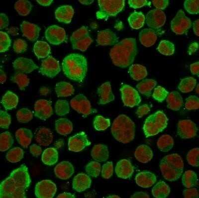 Immunocytochemistry/ Immunofluorescence: Calponin 1 Antibody (CNN1/832) - Azide and BSA Free [NBP2-47757]