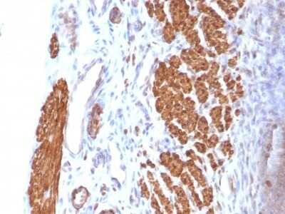 Immunohistochemistry-Paraffin: Calponin 1 Antibody (CNN1/832) - Azide and BSA Free [NBP2-47757]
