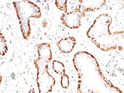 Immunohistochemistry-Paraffin: Calponin 1 Antibody (CNN1/832) - IHC-Prediluted [NBP2-48205]
