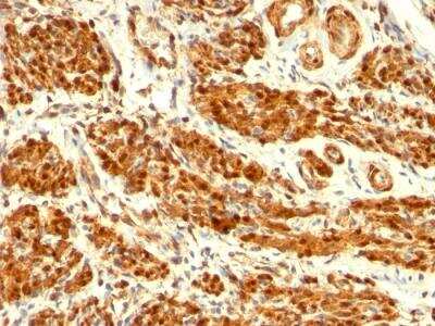 Immunohistochemistry-Paraffin: Calponin 1 Antibody (CNN1/832) - IHC-Prediluted [NBP2-48205]