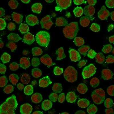 Immunocytochemistry/ Immunofluorescence: Calponin 1 Antibody (CNN1/832) [NBP2-44481]